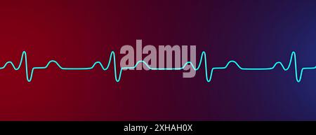 Abbildung eines Elektrokardiogramms (EKG) mit einem Schenkelblock. Dies tritt auf, wenn das elektrische Signal, das das Herz schlägt, durch etwas blockiert oder gestört wird. Das EKG zeigt erweiterte QRS-Komplexe und eine veränderte ventrikuläre Depolarisation. Stockfoto