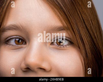 Strabismus des kleinen Patienten, Behandlung der Augenkrankheiten. Weibliche Augen mit Strabismus. Hypertropie. Schiele. Nahaufnahme Teil Kindergesicht, Augen Mädchen Stockfoto