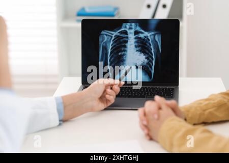Lungenkrebs. Doktor zeigt Thoraxröntgen auf Laptop zu ihrem Patienten in der Klinik, Nahaufnahme Stockfoto