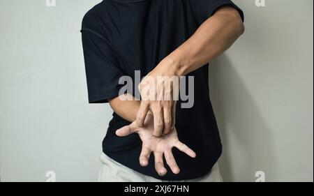 Mann kratzt Juckreiz mit der Hand auf der Plam-Area, Dermatose Stockfoto