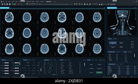 3D-Rendering: Magnetresonanztomographie Brain Scan Mock-up mit mehreren Fenstern und Daten. Professionelle medizinische Forschung Software-Vorlage mit MRT-Ergebnissen für Computerdisplays und Laptop-Bildschirme. Stockfoto