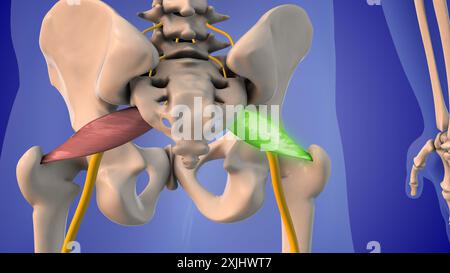 Injektion von Steroiden zur Behandlung des Piriformis-Syndroms Stockfoto