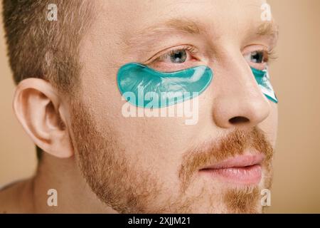 Ein eleganter Mann in lässiger Kleidung mit auffälligen blauen Augenflecken. Stockfoto