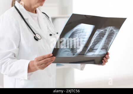 Lungenerkrankungen. Arzt untersucht Thoraxröntgenaufnahme in der Klinik, Großaufnahme Stockfoto