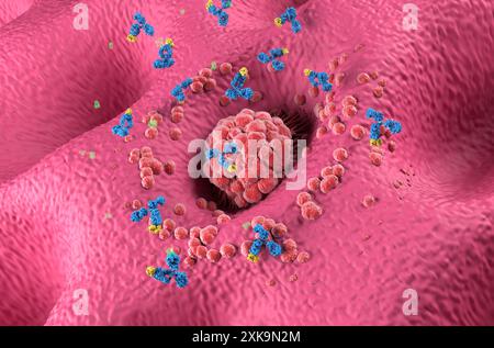 Monoklonale Antikörperbehandlung beim Magenkarzinom (Magen) - isometrische Darstellung 3D-Darstellung Stockfoto