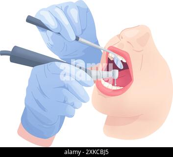 Zahnarzthände bohren Zähne. Zahnchirurgie, Stomatologen Hände in sterilen Handschuhen mit medizinischem Werkzeug Reinigung offener Mund Patient, Zahnheilkunde Zähne Behandlung Swanky Vektor Illustration Stock Vektor