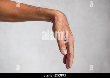 Radialnervenverletzung oder Handgelenktropfen des asiatischen Mannes. Stockfoto