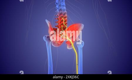 Das medizinische Konzept des Ischiasnervenschmerzes Stockfoto