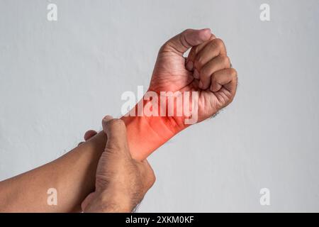 Entzündung des Handgelenkes. Konzept von Gelenkschmerzen, Arthritis, Rheuma, Trauma oder Osteoarthritis. Stockfoto