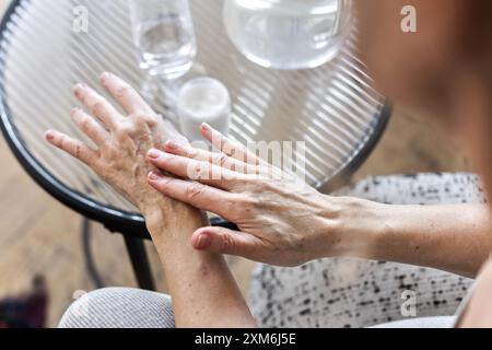 Seniorin in den 60er Jahren, die Handcreme auf die Haut der Hände pflegt Stockfoto