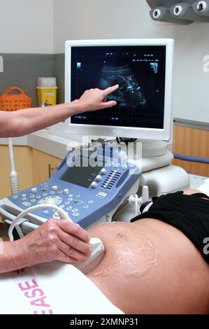 4D Ultraschall-Scan Schwangere Frau Stockfoto