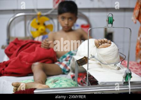 Dhaka, Bangladesch - 30. Juli 2024: Das National Orthopedic Hospital von Dhaka behandelt viele Menschen in den Auseinandersetzungen um die Quotenreformbewegung. Stockfoto