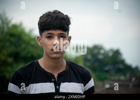 Augengrippe, Patient mit akuter Konjunktivitis, asiatischer Patient hat rote Augen und Schmerzen, Infektion Auge, Hintergrund verschwommen, Stockfoto