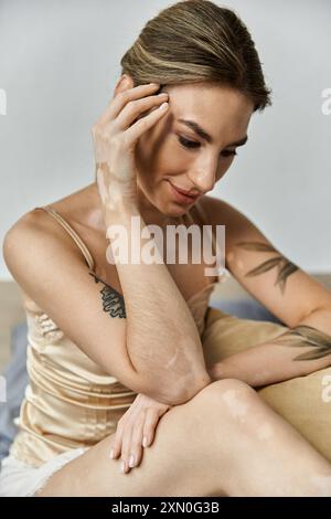 Eine junge Frau mit Vitiligo und Tattoos sitzt in ihrem modernen Apartment-Schlafzimmer, verloren in Gedanken. Stockfoto