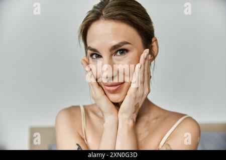 Eine junge Frau mit Vitiligo und einem Tattoo lächelt, während sie ihr Gesicht in ihrem gemütlichen Schlafzimmer berührt. Stockfoto