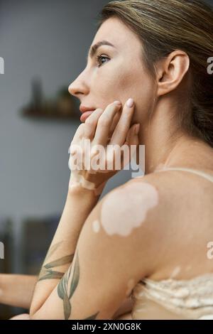 Eine junge Frau mit Vitiligo und einem Tattoo sitzt in ihrem gemütlichen Schlafzimmer, verloren in Gedanken. Stockfoto