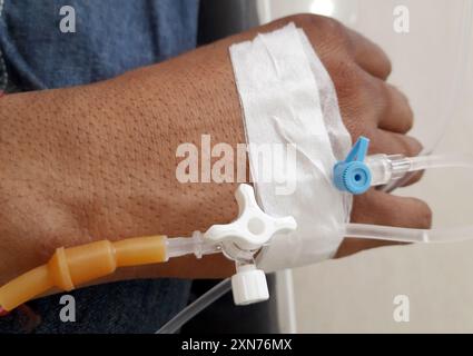 Männlicher Patient in Krankenhaustherapie, Venenkatheter in Armvene einführen Stockfoto