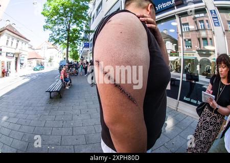 6. August 2024: Cafar J., eines der beiden Opfer des Messerangriffs, zeigt eine seiner Wunden. Die Münchner Polizei organisierte gemeinsam mit der Generalstaatsanwaltschaft einen Live-Wiederaufbau eines angeblich rassistisch motivierten Messerangriffs im Stadtteil Pasing, in einem Stadtteil, in dem sich manchmal viele türkische Männer treffen und manchmal Konflikte entstehen. Seit dem Angriff ist das Gebiet zu einem politischen Brennpunkt für militante türkische Gruppen wie die Grauen Wölfe DITIB und UID geworden, die den Vorfall instrumentalisieren, und sogar den verurteilten Vergewaltiger und Helfer der Terrorgruppe S, FR Stockfoto