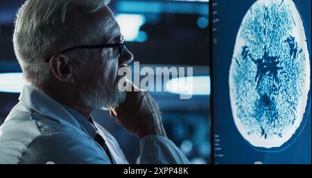 Medical Hospital Research Center: Close-up Portrait des kaukasischen männlichen Neurologen, Neurowissenschaftler, Neurochirurgen, schaut auf TV-Bildschirm mit Gehirn PET Scan Bilder. Der Arzt denkt über die Patientenbehandlung nach. Stockfoto