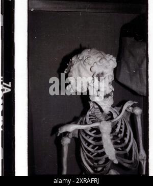 Joseph „John“ Carey Merrick (1862–90) – alias The Elephant man. Pathologische Sammlung des Royal London Hospital in Whitechapel um 1980 Stockfoto