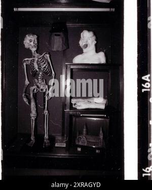 Joseph „John“ Carey Merrick (1862–90) – alias The Elephant man. Pathologische Sammlung des Royal London Hospital in Whitechapel um 1980 Stockfoto