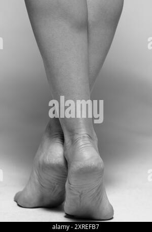 Trockene und rissige Haut auf den Fersen. Problemabsätze, Nahaufnahme. Stockfoto