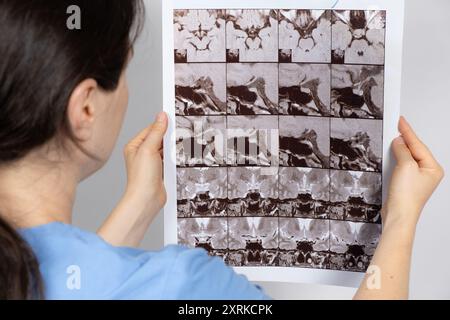 Der Arzt hält ein MRT-Bild der Hypophyse einer gesunden Person. Stockfoto