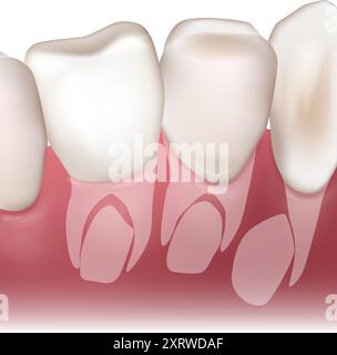 Wachstum bleibender Zähne. Säuglingszähne oder Milchzahn. Anatomische Darstellung mit Molaren und Schneidezähnen. Stock Vektor