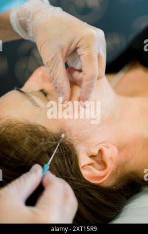 Nahaufnahme eines ästhetischen klinischen Eingriffs, bei dem ein Praktizierender mit Handschuhen botox, Hyaluronsäure und Tensorfäden auf das Gesicht einer Frau W aufträgt Stockfoto