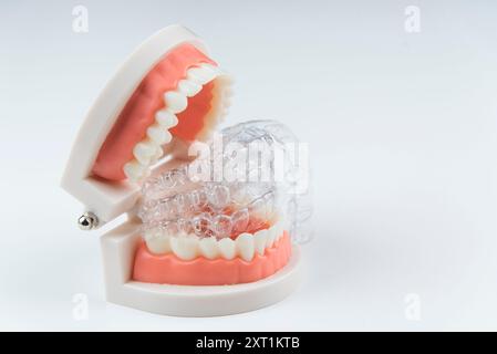Zahnärztliche Versorgung. Aligner werden auf einem künstlichen Modell eines menschlichen Kiefers platziert. Stockfoto