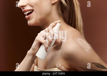 Eine junge Frau mit Vitiligo lächelt hell, als sie ein Hautpflegeprodukt auf ihre Schulter aufträgt. Stockfoto