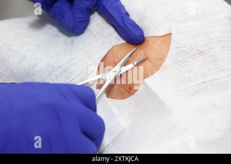 Dermatologe, der eine Hautbiopsie im Gesicht eines älteren erwachsenen Patienten durchführt. Arzt, der einen Patienten während einer kleinen Operation näht. Stockfoto