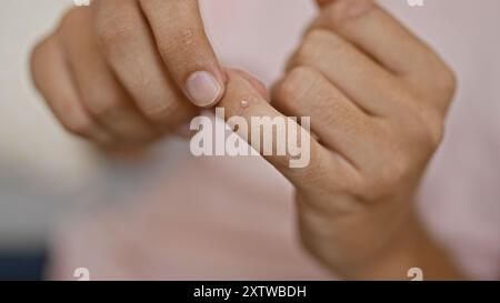 Nahaufnahme einer kleinen Wunde am Finger eines Mannes, die von einer anderen Person sorgfältig untersucht wurde, mit Fokus auf die Verletzung. Stockfoto