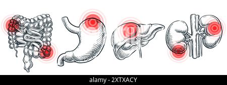 Innere Organerkrankungen, Krankheiten und Entzündungen. Abstraktes Schmerzlokalisationssymbol. Illustration medizinischer Vektorskizzen. Handgezeichnete Kritzelanatomie Stock Vektor