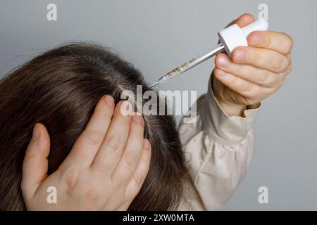 Frau mit Kahlköpfigkeit. Mann, der Dermatologie kosmetisch anwendet. Anti-Haarausfall-Klinikserum. Naturhaarpflegeverfahren. Stockfoto