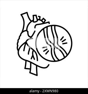 Schwarzes Symbol für Myokardiopathie. Signieren Sie für Webseite, mobile App, Schaltfläche, Logo. Schaltfläche Vektorisoliert. Bearbeitbare Kontur. Stock Vektor