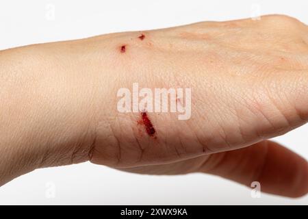 Die Frau zeigt tiefe Schnitte an ihrem Handrücken Stockfoto