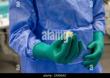 Herzklappenchirurgie Kardiologie für Patienten im Krankenhaus. Transkatheter-Aortenklappenimplantation in der Hand des Arztes vorbereiten. Herzklappe Stockfoto
