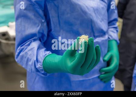 Herzklappenchirurgie Kardiologie für Patienten im Krankenhaus. Transkatheter-Aortenklappenimplantation in der Hand des Arztes vorbereiten. Herzklappe Stockfoto