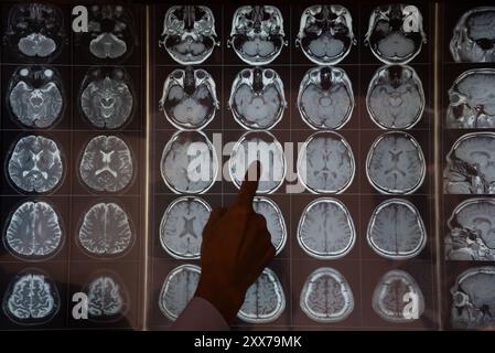 Ein medizinisches Fachpersonal untersucht mehrere MRT-Gehirnscans, die auf einem Bildschirm angezeigt werden, wobei der Schwerpunkt auf neurologischer Analyse und Diagnose liegt. Stockfoto