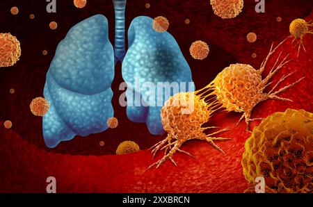 Lungenkrebs oder Lungenkarzinom-Diagnose und Symptome der menschlichen Lungenerkrankung Konzept als Verschlechterung der Atemfunktion durch einen Tumor. Stockfoto