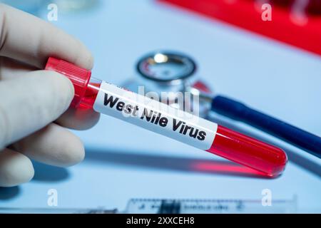 Patienten mit Verdacht auf West-Nil-Virus (WNV) sollten zunächst auf WNV-spezifische Immunglobulin (IG)M-Antikörper im Serum getestet werden Stockfoto