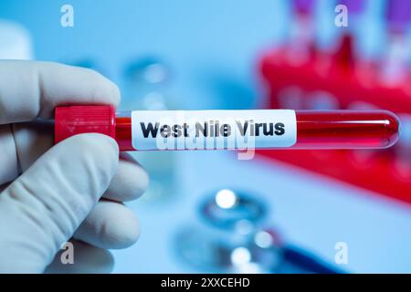 Patienten mit Verdacht auf West-Nil-Virus (WNV) sollten zunächst auf WNV-spezifische Immunglobulin (IG)M-Antikörper im Serum getestet werden Stockfoto