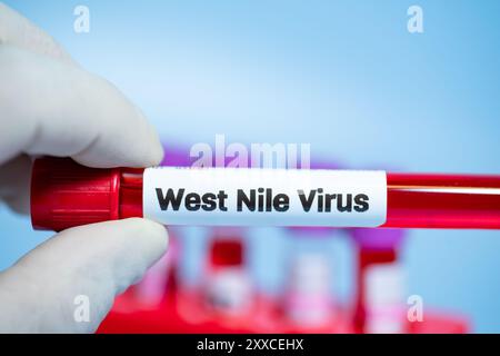 Patienten mit Verdacht auf West-Nil-Virus (WNV) sollten zunächst auf WNV-spezifische Immunglobulin (IG)M-Antikörper im Serum getestet werden Stockfoto