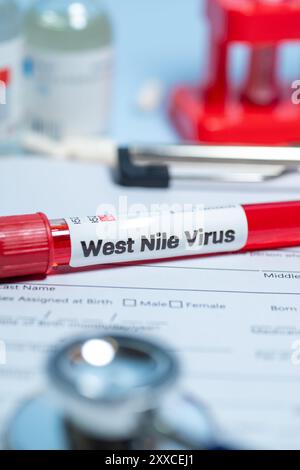 Patienten mit Verdacht auf West-Nil-Virus (WNV) sollten zunächst auf WNV-spezifische Immunglobulin (IG)M-Antikörper im Serum getestet werden Stockfoto