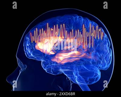 Abbildung: Gammawellen in einem menschlichen Gehirn. Gammawellen haben eine Frequenz von 30-100 Hz und sind mit höheren Gehirnfunktionen wie Arbeitsgedächtnis, Aufmerksamkeit und Wahrnehmungsgruppierung assoziiert. Abnormale Gammawellenaktivität ist mit gesundheitlichen Problemen wie Alzheimer assoziiert. Stockfoto