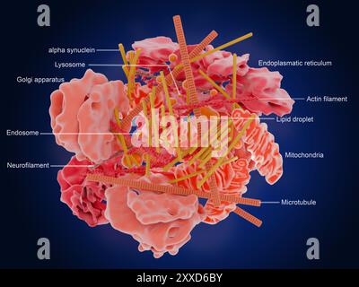 Beschriftete Abbildung, die die Molekülstruktur eines Lewy-Körpers zeigt. Lewy-Körper sind abnorme Aggregationen von Proteinen, gestörten Organellen und Membranlipiden. Ihre Bildung in Nervenzellen im Gehirn ist mit den neurodegenerativen Erkrankungen Parkinson und Lewy-Body-Demenz assoziiert. Stockfoto