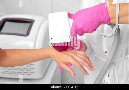 ELOs-Epilierungs-Haarentfernungsverfahren an einem Frauenkörper. Kosmetikerin, die Laserverjüngung an der Hand in einem Schönheitssalon macht. Gesichtshaut-Pflege. Hardware Stockfoto