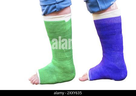 Teenager geht mit zwei bunte Gips Beine auf weißem Hintergrund Stockfoto