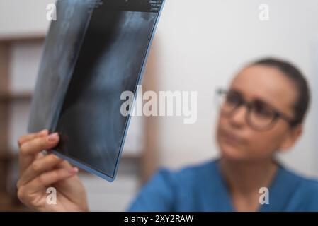 Nahaufnahme einer Ärztin, die einen Röntgenfilmscan durchführt und die radiologischen Ergebnisse korreliert Stockfoto